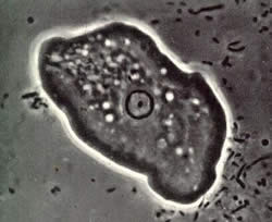 Amebiasi