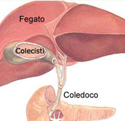 Calcoli alla colecisti