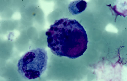 CMV