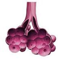Enfisema