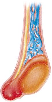 Epididimite