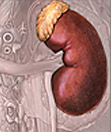 Feocromocitoma