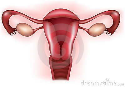 fibroma uterino