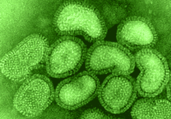 Influenza