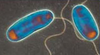 legionella