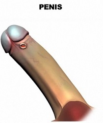 vlac