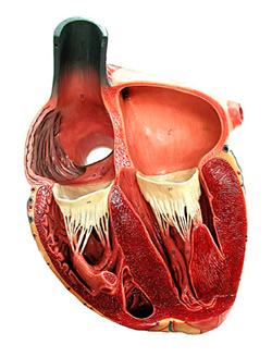 Tachicardia