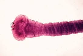 Tenia solium