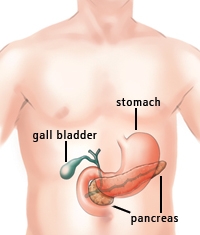 Tumore del pancreas