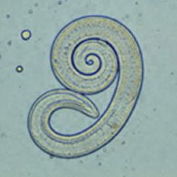 Trichinella