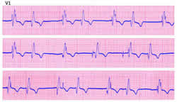 Elettrocardiogramma