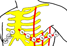 Elettrodi