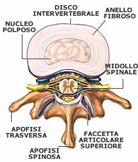 Dischi intervertebrali